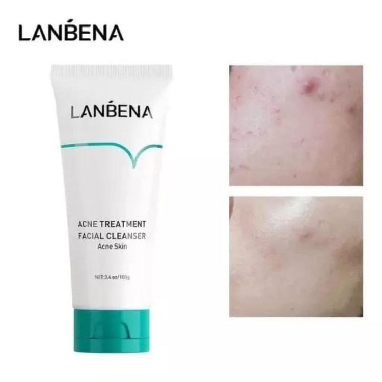 فوم شستشوی صورت ضد جوش برند لانبنا Lanbena