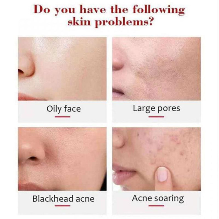 ژل لایه بردار و سفید کننده ایچون بیوتی عصاره توت فرنگی
