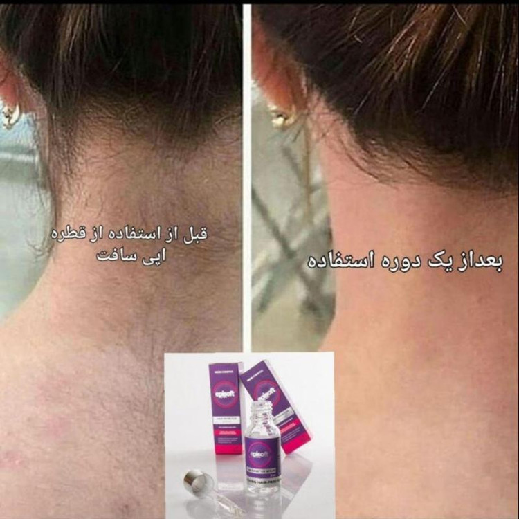 سرم موبر دائمی اپی سافت Episoft (حجم 30 میلی لیتر)