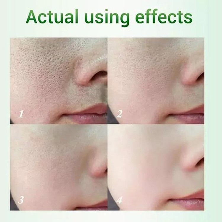 سرم کوچک کننده منافذ پوست بریلی Breylee Pore Minimizer Serum Step 2 حجم 17 میل