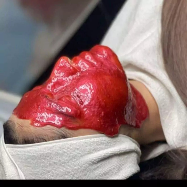 ماسک دوفازگل رز برند ایرفلند