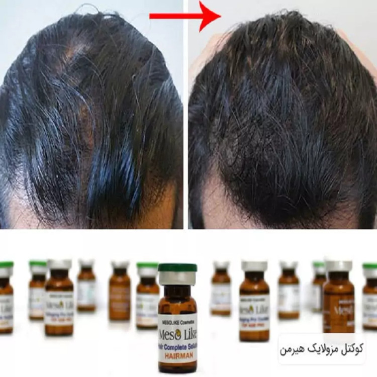 کوکتل تقویت کننده مو آقایان هیر من برند مزو لایک MESO LIKE