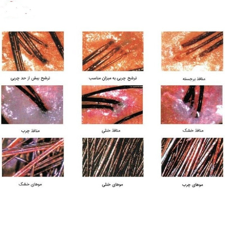 دستگاه اسکن و آنالیزور پوست کلین klin
